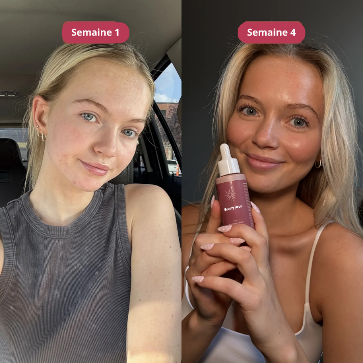 Sunny Drop | Gouttes autobronzantes