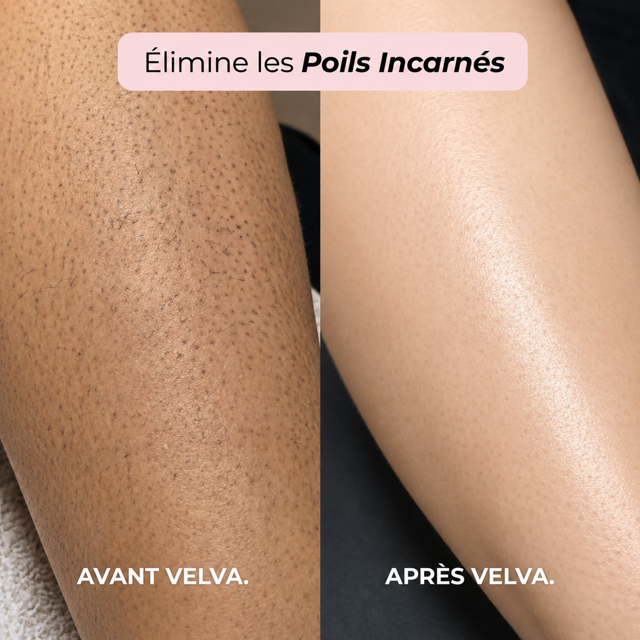 Velva™ | Rasoir 2-en-1 corps et maillot