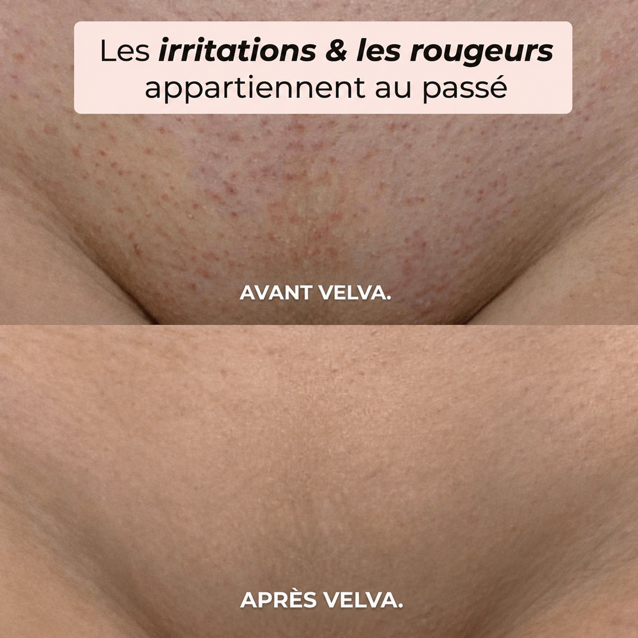 Velva™ | Rasoir 2-en-1 corps et maillot