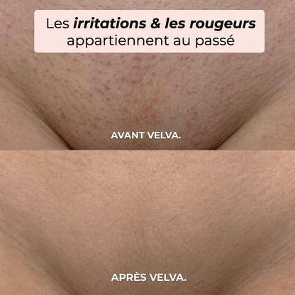 Velva™ | Rasoir 2-en-1 corps et maillot