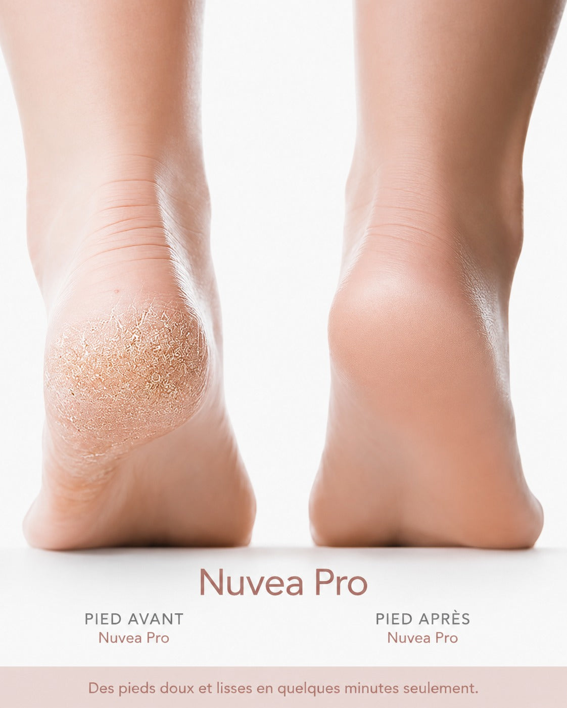 Nuvea Pro™